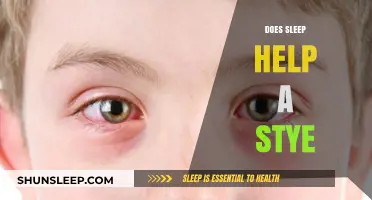 Sleep and Styes: How Rest Aids Healing and Recovery