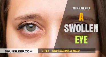 Can Sleep Reduce Swollen Eyes? Discover the Healing Power of Rest