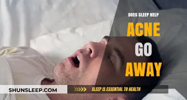 Sleep and Acne: Uncovering the Link to Clearer Skin