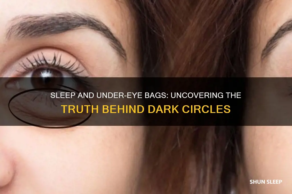 does sleep help bags under eyes