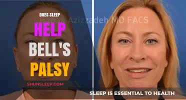 Sleep and Bell's Palsy: Uncovering the Healing Connection for Recovery
