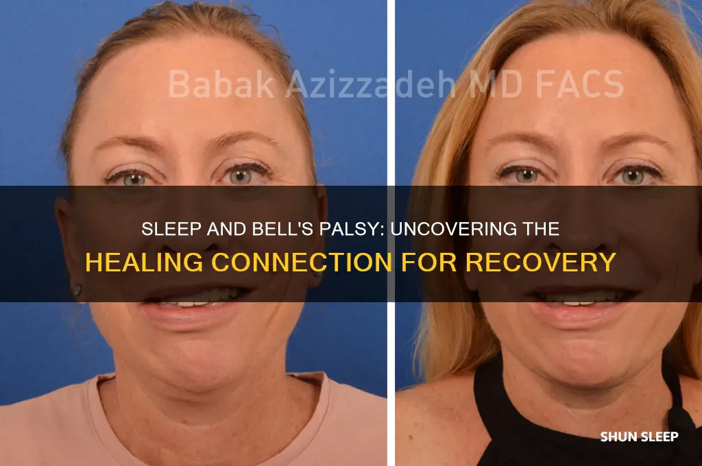 does sleep help bell