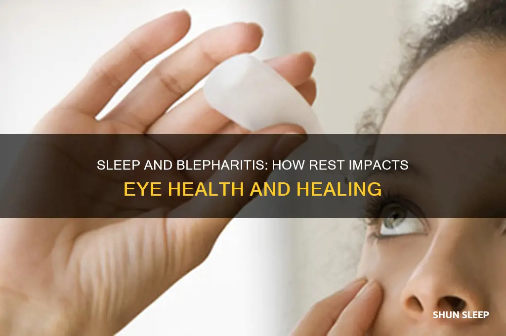 does sleep help blepharitis