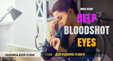Sleep and Bloodshot Eyes: How Rest Revives Red, Tired Eyes