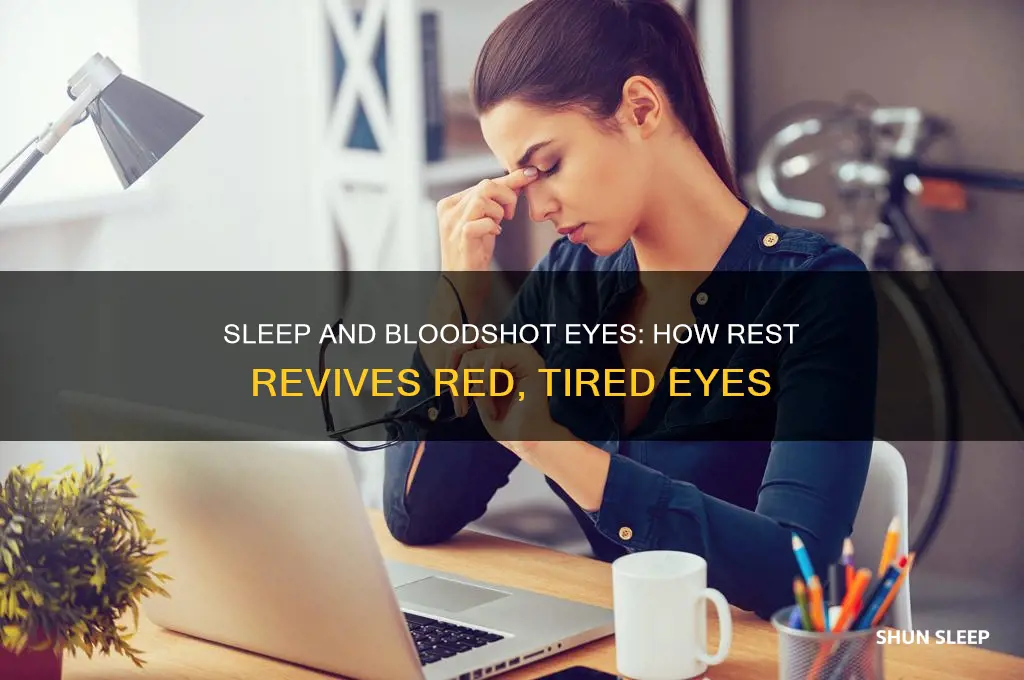 does sleep help bloodshot eyes
