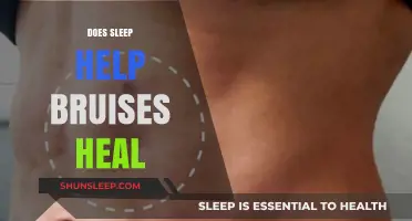 Sleep and Bruise Healing: Uncovering the Restorative Power of Slumber
