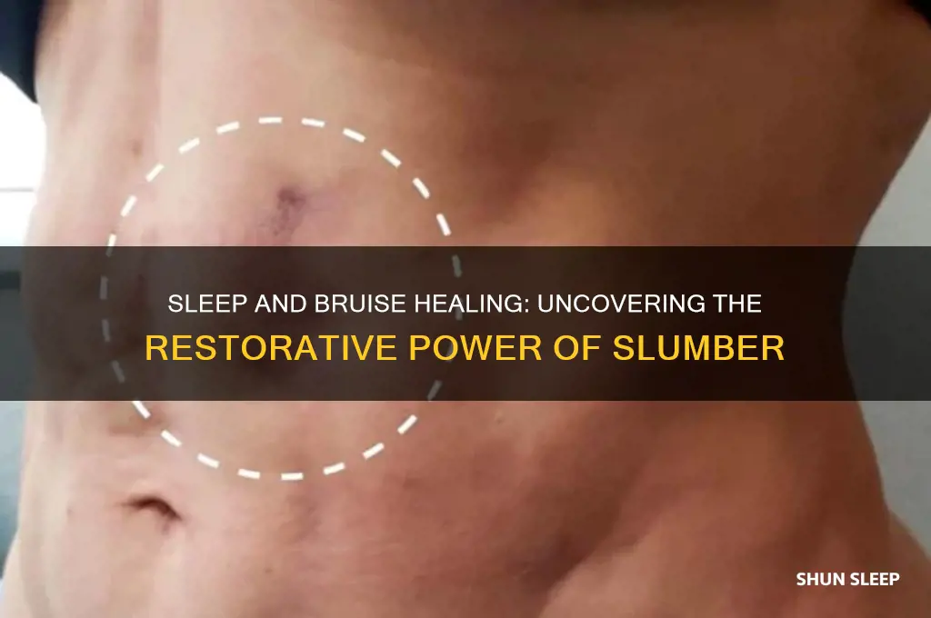 does sleep help bruises heal