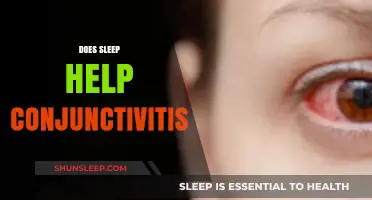 Sleep and Conjunctivitis: How Rest Impacts Eye Health Recovery