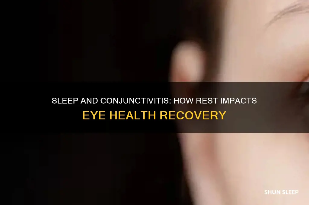 does sleep help conjunctivitis
