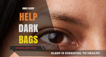 Sleep and Dark Circles: Uncovering the Truth Behind Under-Eye Bags