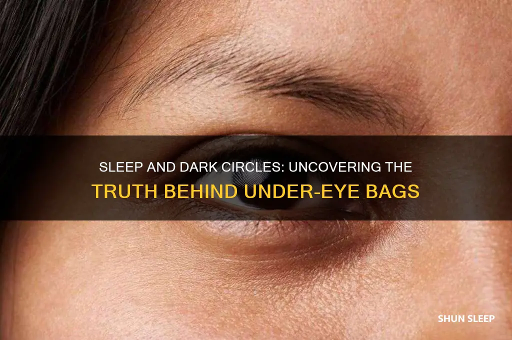 does sleep help dark bags
