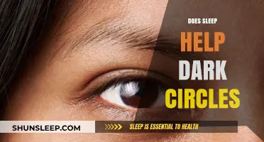 Sleep and Dark Circles: Uncovering the Truth Behind Under-Eye Shadows