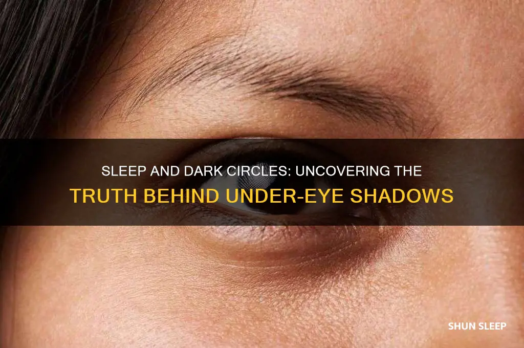 does sleep help dark circles