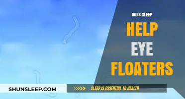 Sleep and Eye Floaters: Can Rest Reduce Those Annoying Spots?