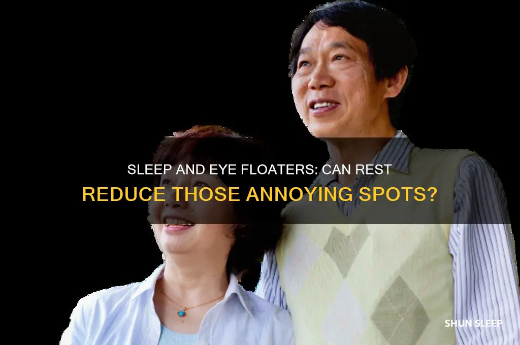 does sleep help eye floaters