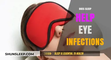 Sleep and Eye Infections: How Rest Aids Healing and Recovery