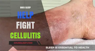 Sleep and Cellulitis: How Rest Aids in Fighting Skin Infections