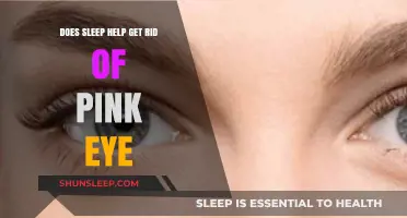 Sleep and Pink Eye: Can Rest Aid in Conjunctivitis Recovery?