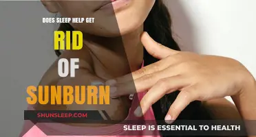 Can Sleep Aid Sunburn Recovery? Exploring the Healing Power of Rest