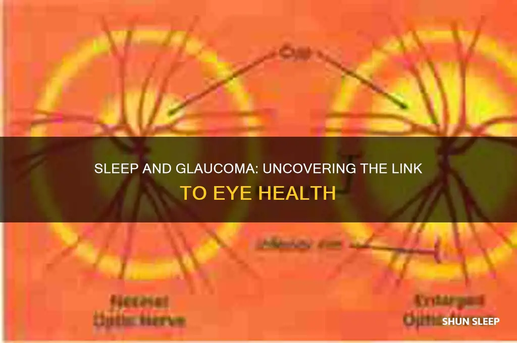 does sleep help glaucoma