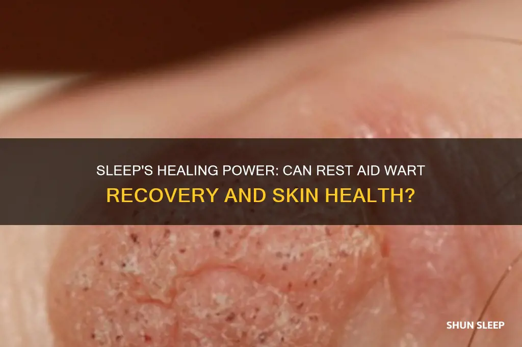 does sleep help heal wartd
