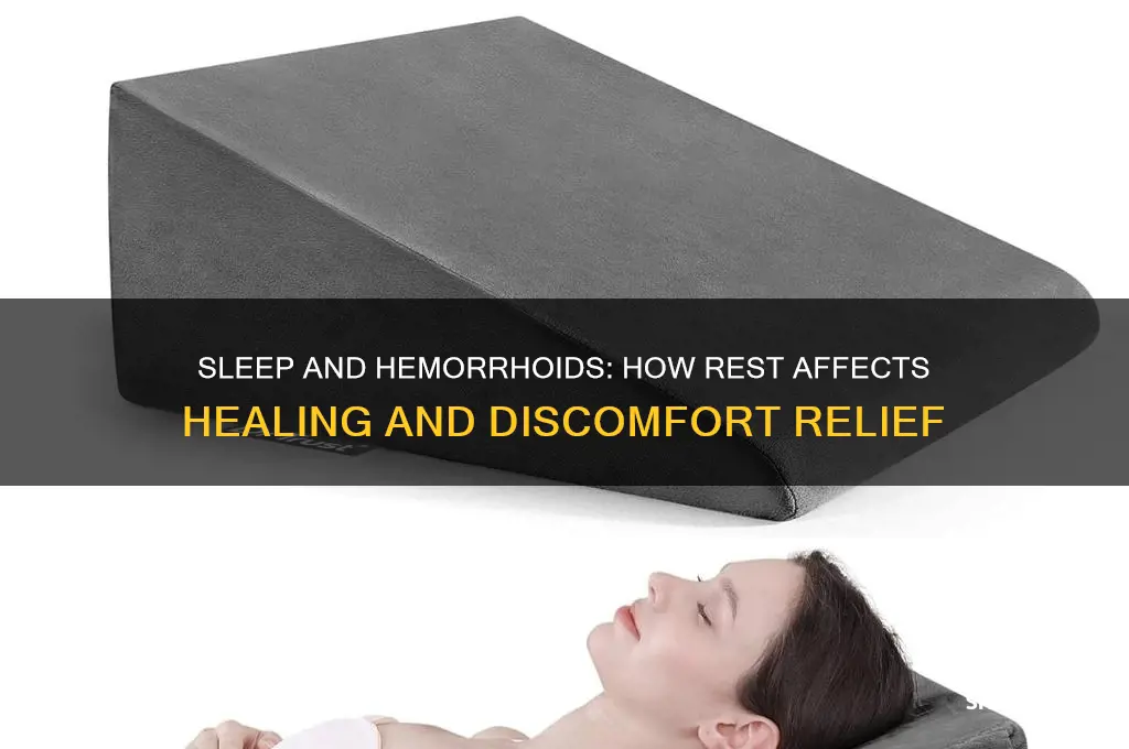does sleep help hemorrhoids