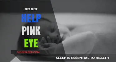Sleep and Pink Eye: How Rest Aids Conjunctivitis Recovery
