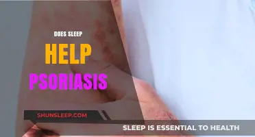 Sleep and Psoriasis: Uncovering the Healing Power of Rest