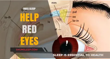 Sleep and Red Eyes: How Rest Relieves Irritated, Bloodshot Eyes