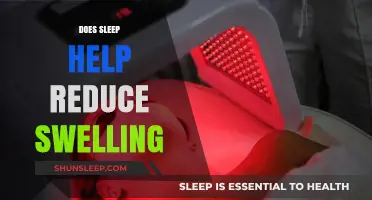 Sleep and Swelling: How Rest Aids in Reducing Inflammation