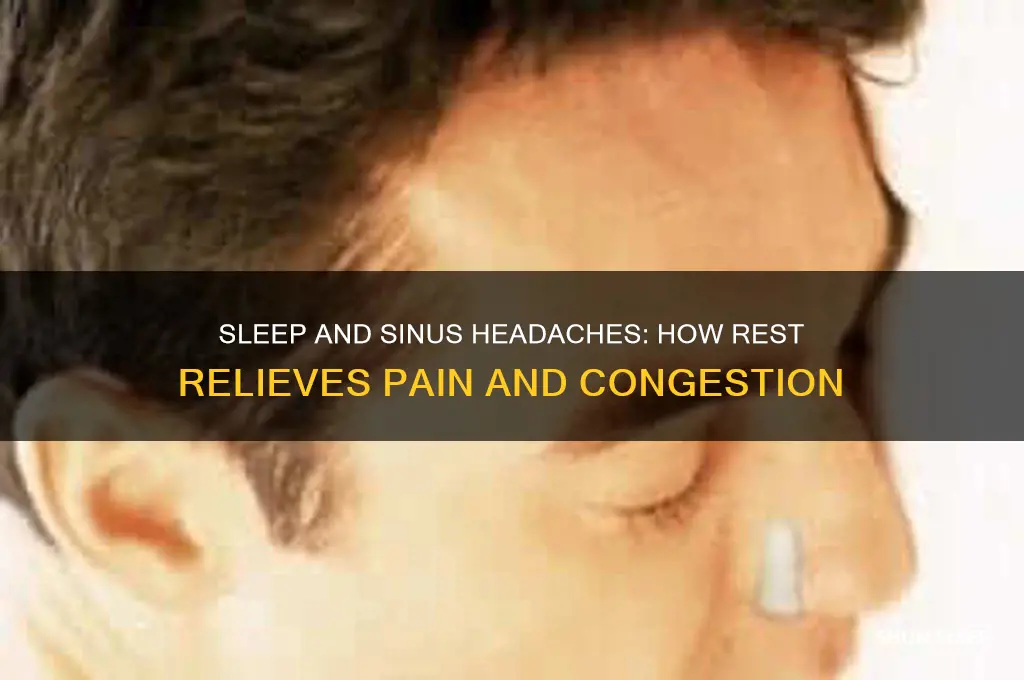 does sleep help sinus headache