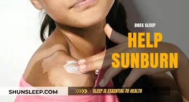 Can Sleep Soothe Sunburn? Exploring the Healing Power of Rest