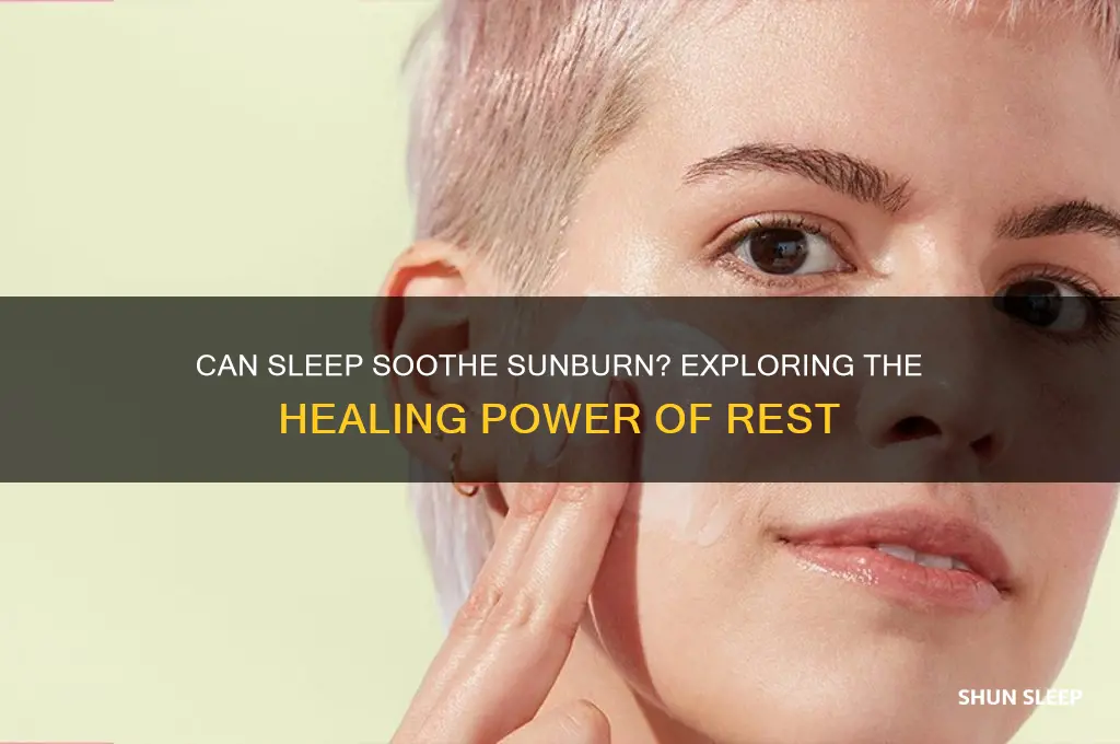 does sleep help sunburn