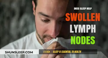Sleep and Swollen Lymph Nodes: How Rest Aids Recovery