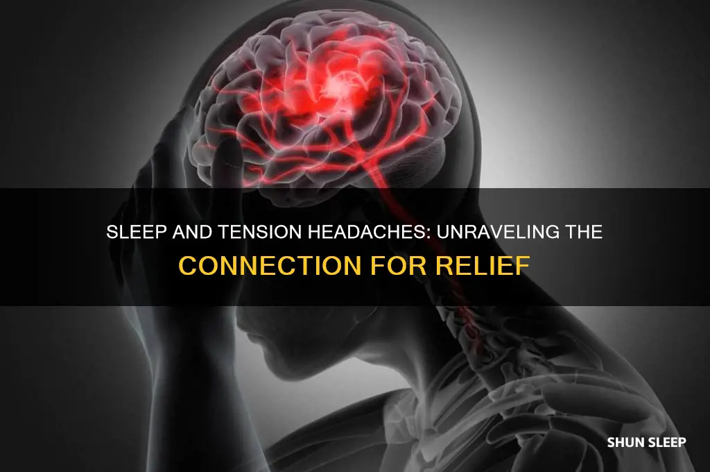 does sleep help tension headaches