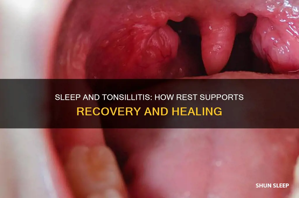 does sleep help tonsillitis
