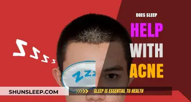 Sleep and Acne: Uncovering the Link for Clearer Skin
