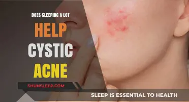 Can Extra Sleep Improve Cystic Acne? Uncovering the Skin-Rest Connection