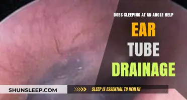 Sleeping at an Angle: Does It Aid Ear Tube Drainage?