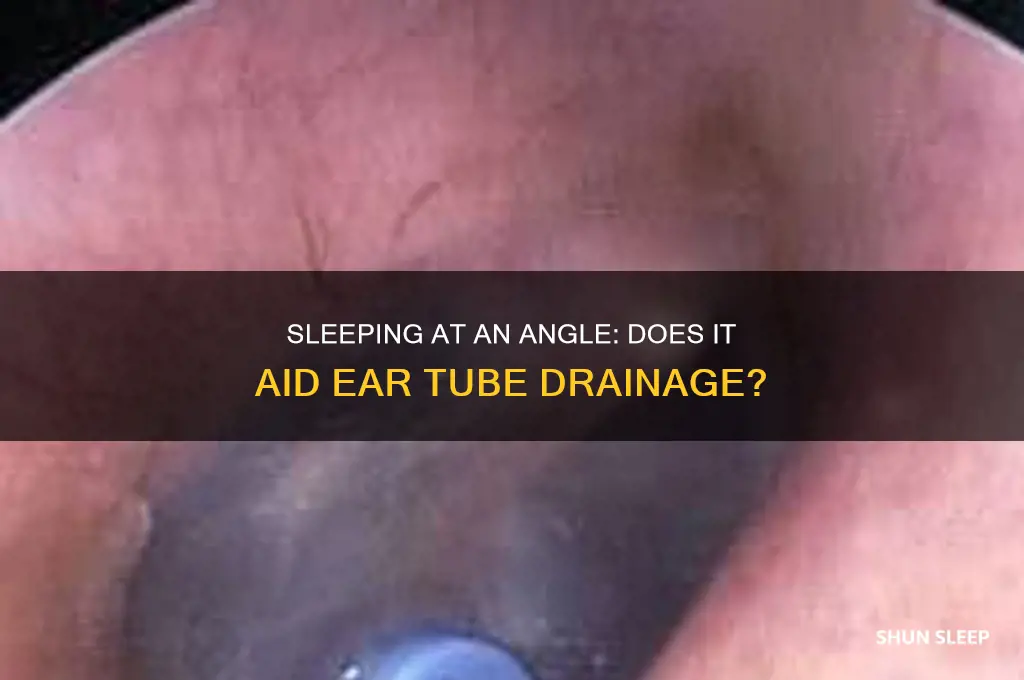 does sleeping at an angle help ear tube drainage