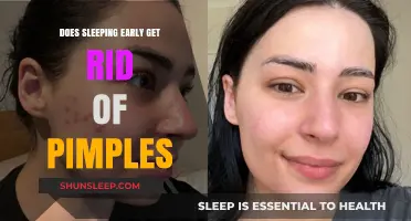 Early Bedtime: The Secret to Clearer Skin and Fewer Pimples?