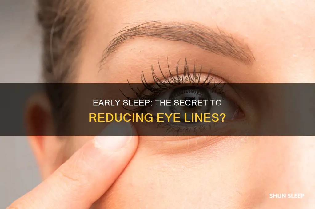 does sleeping early help eye lines