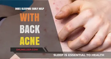 Early Sleep: A Natural Remedy for Back Acne?