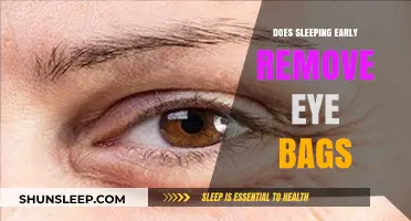 Early Sleep, Eye Bags: Does it Work?