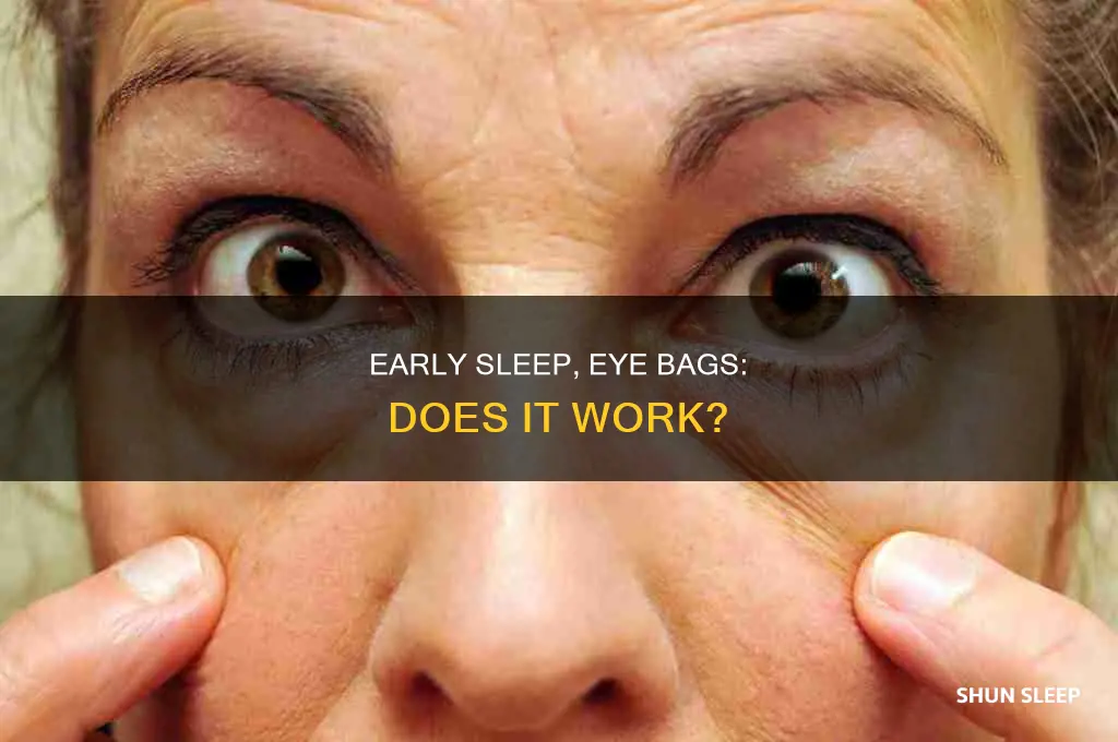 does sleeping early remove eye bags