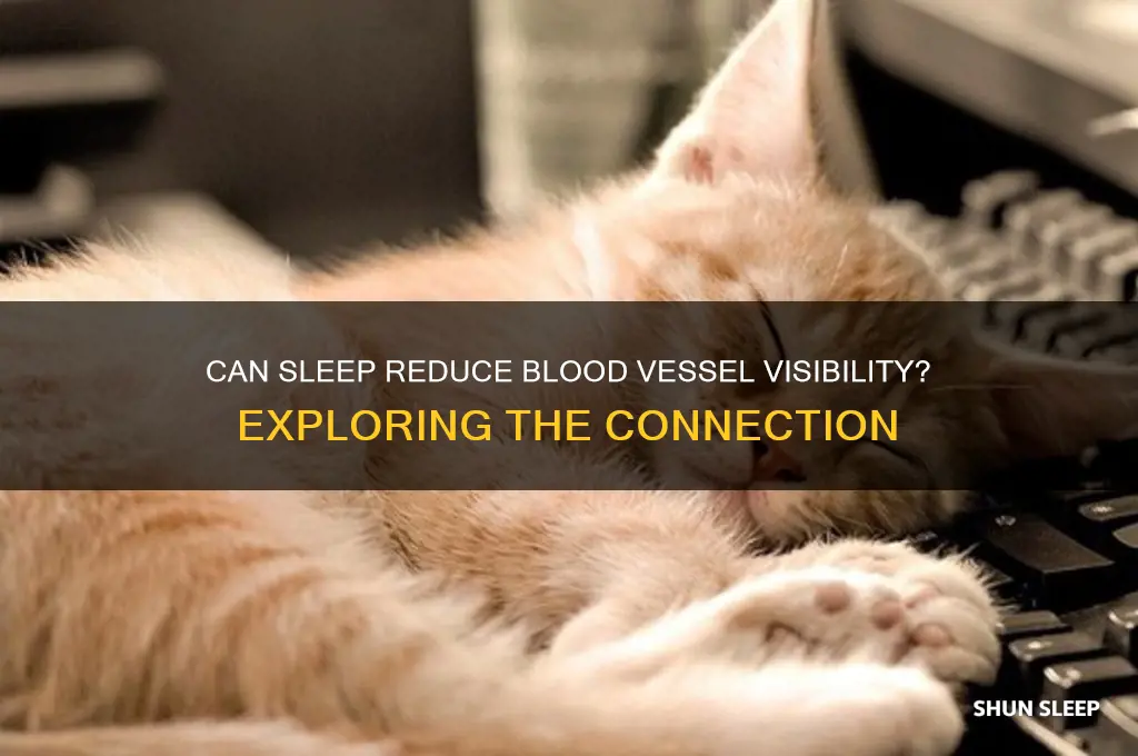 does sleeping help blood vessel go away