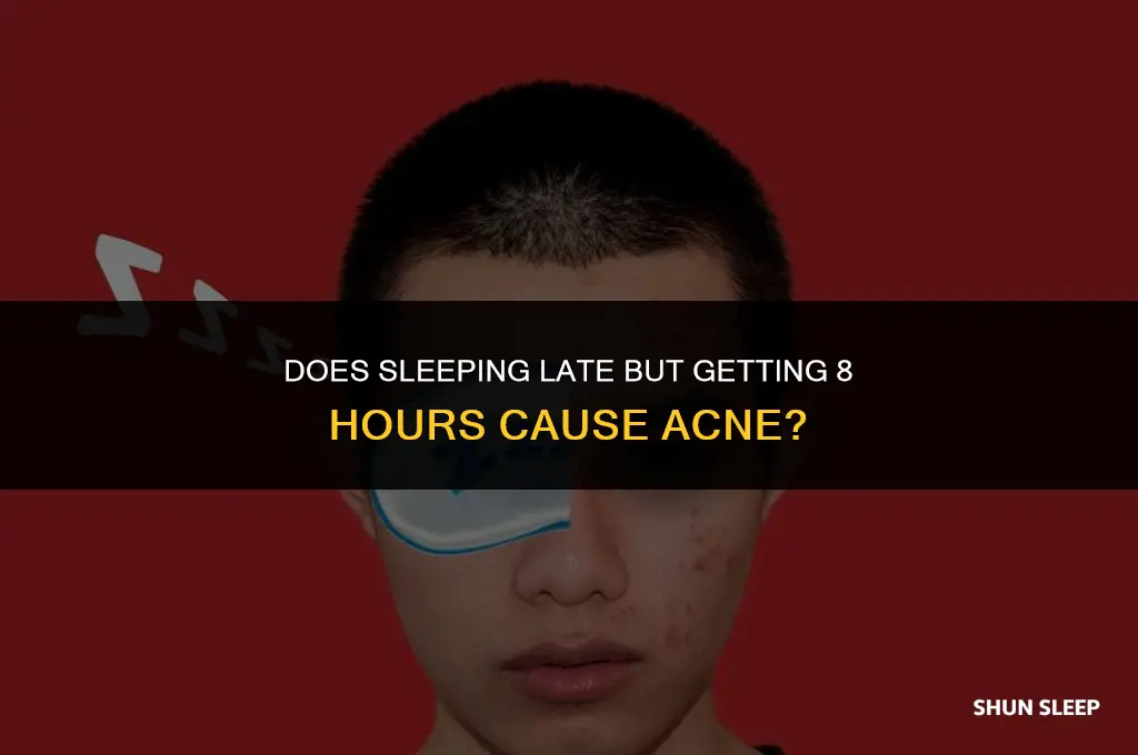 does sleeping late but getting 8 hours cause acne