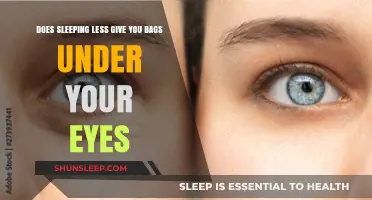 Sleep Deprivation: The Cause of Under-Eye Bags?
