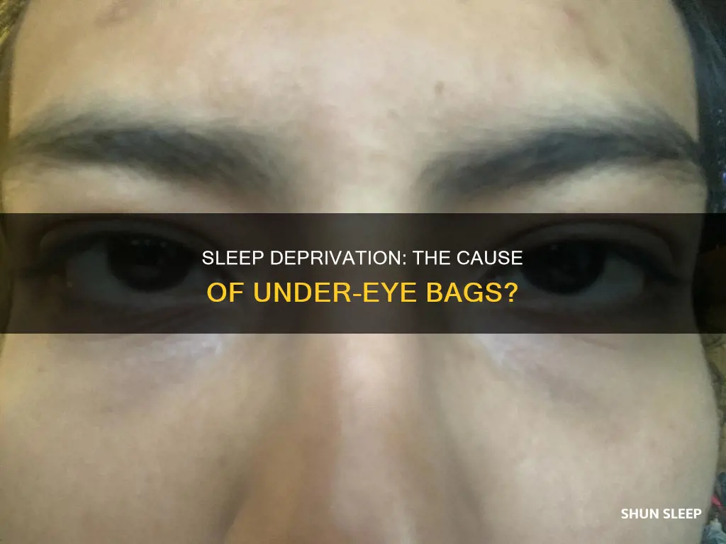 does sleeping less give you bags under your eyes