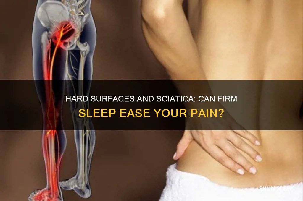 does sleeping on a hard surface help sciatica